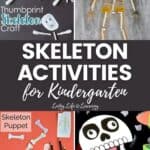 Skeleton Activities for Kindergarten