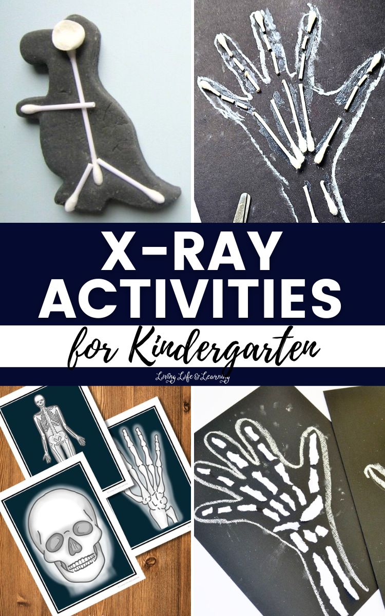 X-ray Activities for Kindergarten